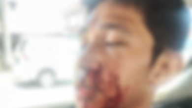Photo of Diduga Menganiaya Dilla Atlet Ber prestasi Olahraga Muaythai Balikpapan, HP Dilaporkan ke Polisi